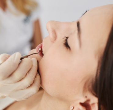 Dental practitioner putting filling material in tooth with plugger